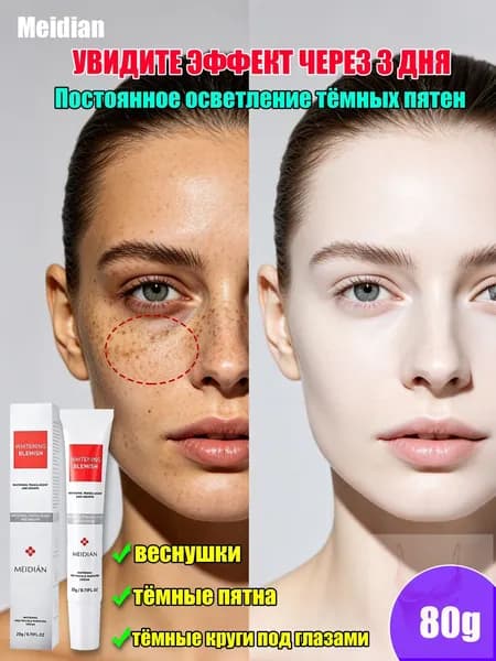 MEIDIAN Крем для отбеливания веснушек, осветление пигментных пятен, меланодермия, подбитый глаз 20g 4 шт