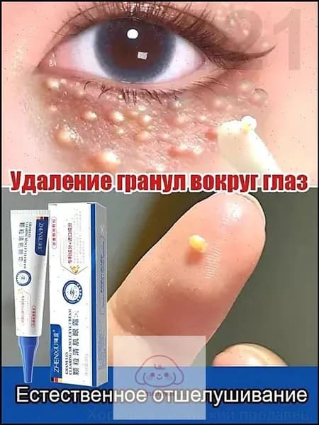 Эксклюзивный крем для век против жировиков, разглаживающий кожу и устраняющий дефекты, 30 г