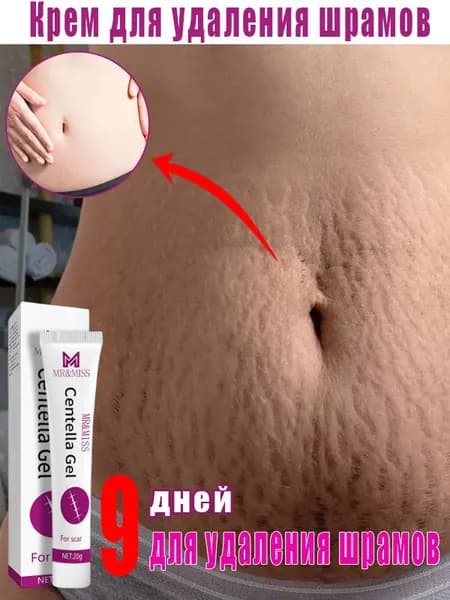 Средство от растяжек