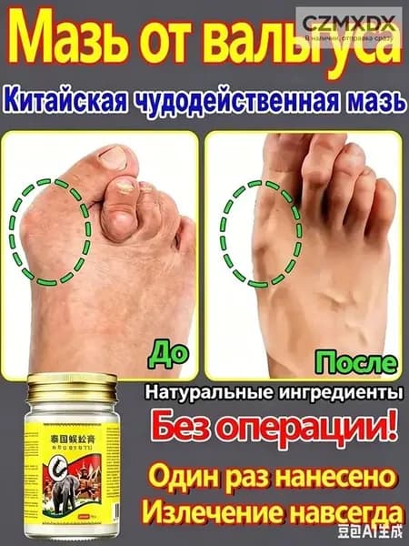 Крем при вальгусной деформации, от шишек на больших пальцах ног, Боль в суставах, подагра20 г
