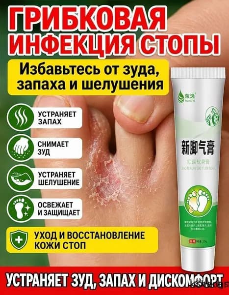 Крем от грибка стопы,быстрое снятие зуда между пальцами, устранение шелушения и неприятного запаха