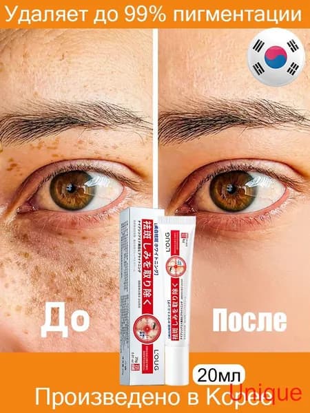 Содержит ниацинамид/Крем от пигментных пятен для лица Корея/20 мл/Содержит активные осветляющие компоненты/Устраняет мелазму, пигментацию, солнечные и тёмные пятна, интенсивно осветляет кожу
