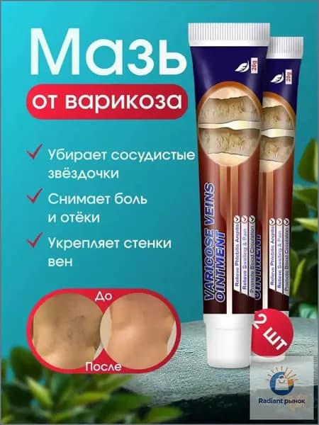 Мазь от варикоза и отёков ног 2шт , Средство при усталости вен