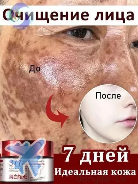 Крем для кожи: против веснушек и пигментных пятен, антипигментационный, отбеливающий, увлажняющий, 30 г, 1 шт