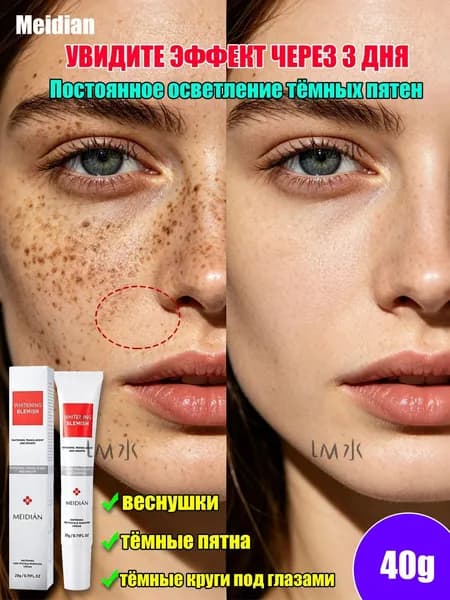 Meidian Крем для отбеливания веснушек и осветления пигментных пятен, средство от меланодермии, 20 г 2 шт
