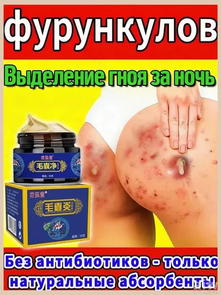 Качественный крем от просянки и кист, для кожи лица применяемый tangyueshangmao2
