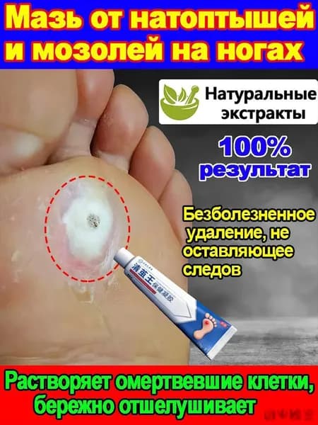 Mазь от мозолей стержневых и натоптышей ,Крем от сухих мозолей, шипицы, бородавок, Китайская чудодейственная мазь 20 г