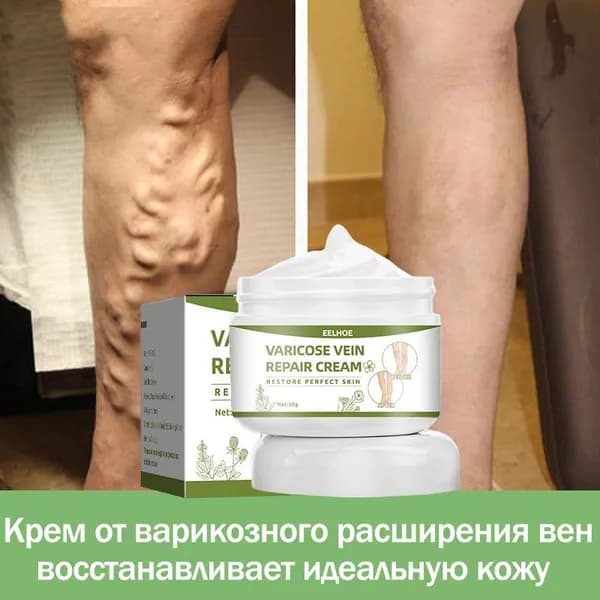 Крем для лечения варикозного расширения вен 50г Эффективное средство для снятия отечности ног, варикозного расширения вен, усталости и боли