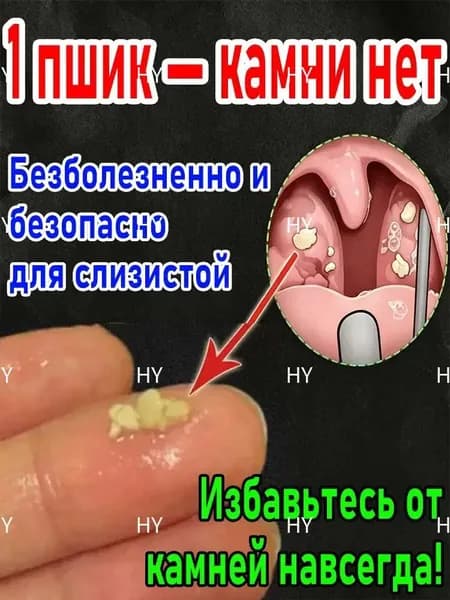 Прибор и спрей для очистки миндалин от пробок-6