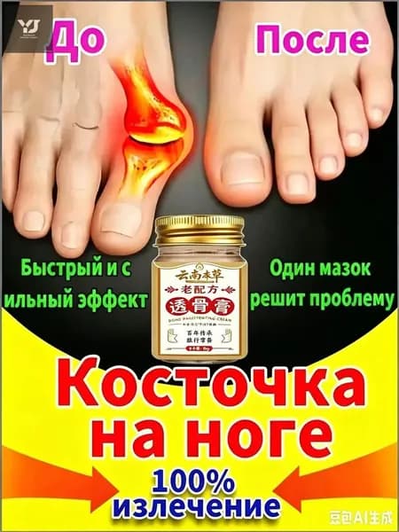 Мазь при вальгусной деформации косточки обезболивающая 55 г