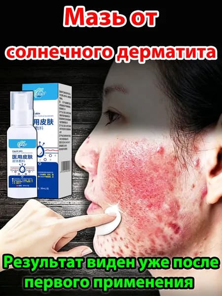 Крем для лечения солнечного дерматита,Восстановление кожи после солнечных ожогов крем после загара