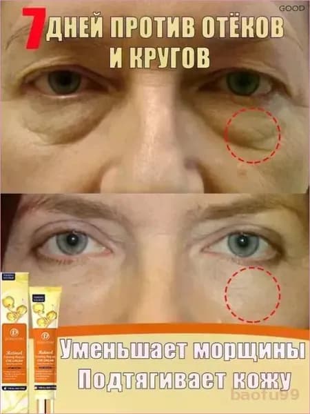 Антивозрастной крем для глаз с ретинолом, устраняет морщины, отеки и темные круги под глазами, увлажняет и осветляет кожу, 20 г