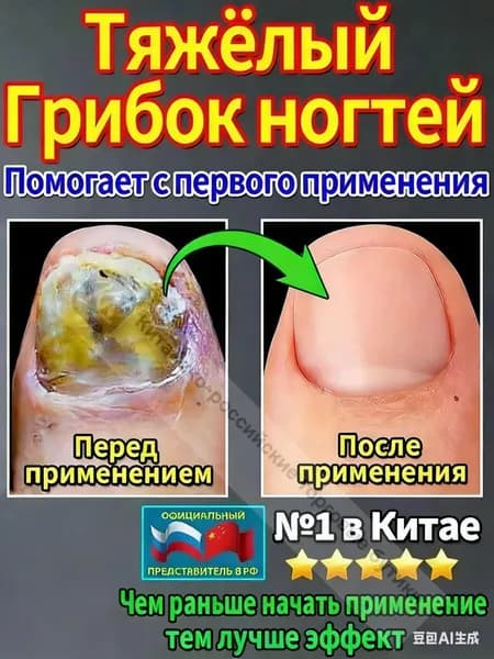 мазь ноготок от грибка ногтей на ногах,Лечите грибковые инфекции, укрепляйте и восстанавливайте ногти и рого