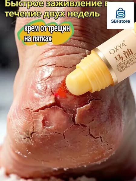 Эксклюзивный состав с 5 мочевиной применяется для очень сухой кожи, восковым средством обрабатываются трещины на пятках.
