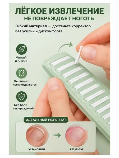 Корректор От Вросших Ногтей На Ногах