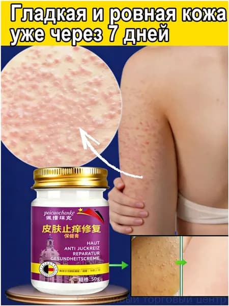Крем для тела от гусиной кожи и сухости 55ml