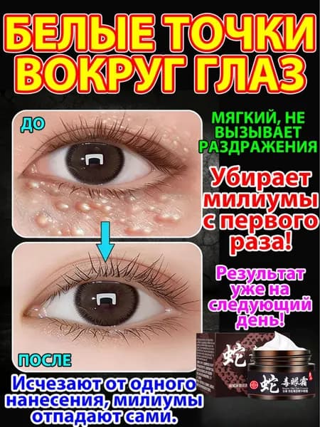 Мазь от жировики под глазами Милиумы Просянка