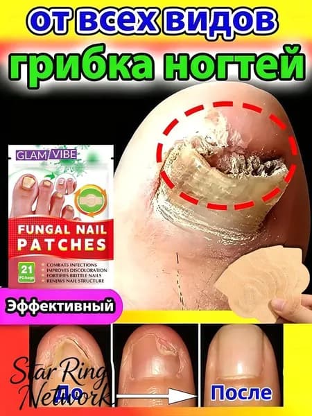 Пластырь от грибка ногтей на ногах, используется для лечения грибковых инфекций, мощное противогрибковое средство, 21 пластырь в упаковке