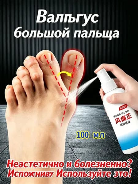 мазь от косточки на большом пальце, от шишек на больших пальцах ног