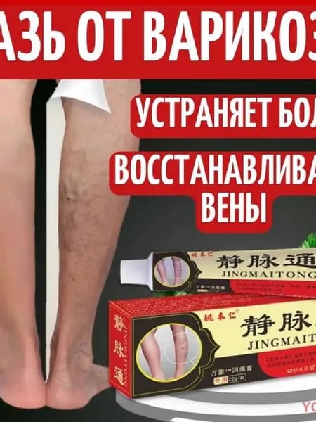 Китайская мазь от варикоза вен на ногах Джинг Май Тонг
