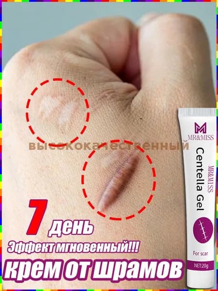 Средство для уменьшения растяжек