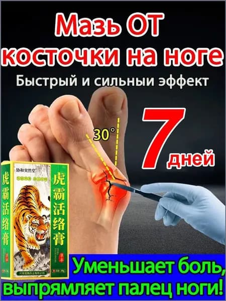 Мазь от вальгусной деформации стопы/20 мл, специальная для лечения воспаленных костей стопы