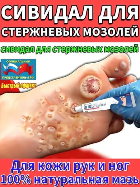 Китайская Чудл Мазь средство от папиллом и бородавок. Эффективный крем для быстрого избавления бородавок, мозольный удаления мозолей, натоптышей 20 г