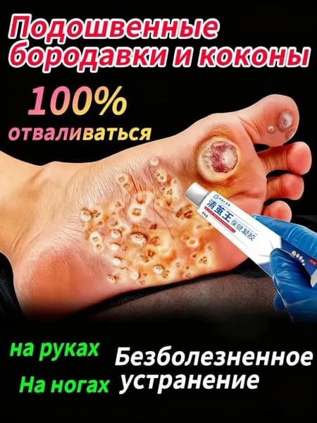 Китайский секретный рецепт Эффективный крем для быстрого избавления бородавок, мозольный удаления мозолей, натоптышей 20 г