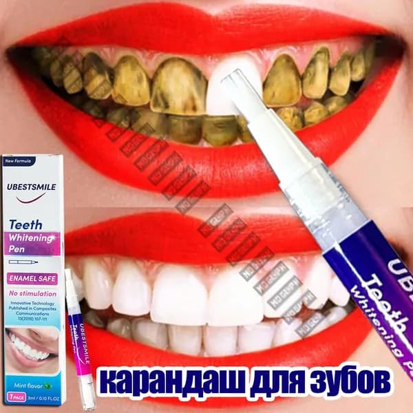 Профессиональный отбеливающий карандаш для зубов, устраняет налет от сигарет и кофе, отбеливание. Две штуки