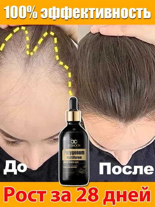 Масло для роста волос активатор