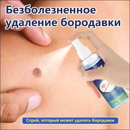Средство от папиллом, бородавок и сухих мозолей Безопасно, без побочных эффектов. 30мл