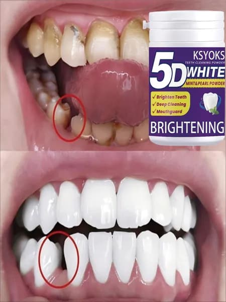 Дентальный гель KSYOKS 5D WHITE (мята + жемчуг): отбеливание зубов, глубокая очистка и защита зубов , сильный эффект осветления