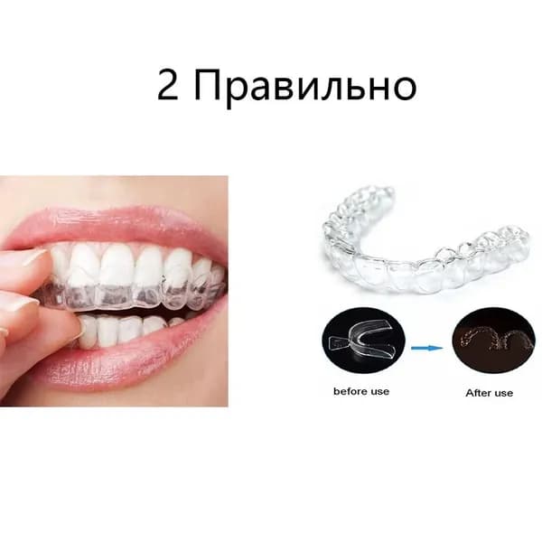 Многослойная защитная каппа из ЭВА от бруксизма, для отбеливания и занятий боксом