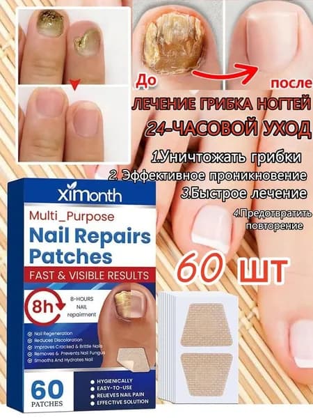 Пластыри для ухода за ногтями 60шт.,Для лечения грибковых инфекций, вросших ногтей и т. д.