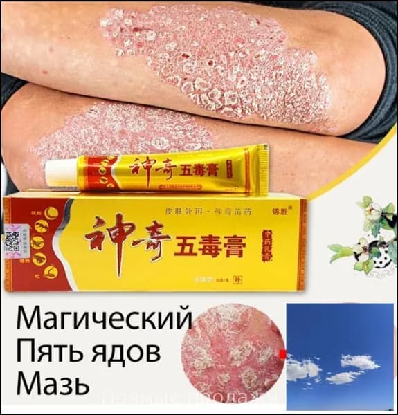 Эксклюзивный травяной крем 15 г для детоксикации и облегчения зуда от Yiganerjing создан на основе мази пяти ядов