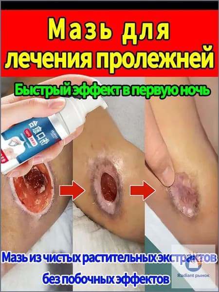 Средство от пролежней для лежачих больных, спрей для заживления ран, антибактериальный уход за кожей