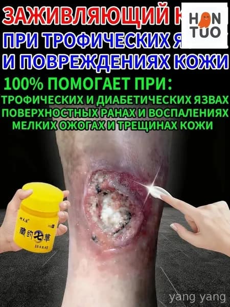 Крем при трофических язвах и сухих трещинах кожи