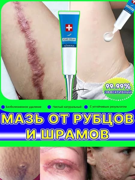 Гель от рубцов: для лечения растяжек, угревой сыпи, ожогов, послеоперационных и келоидных рубцов, 20 мл