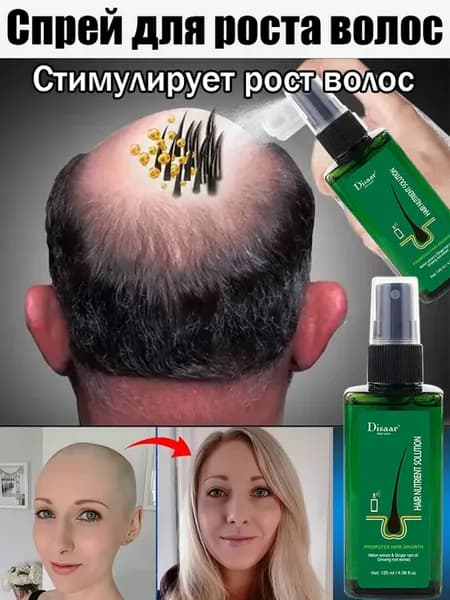 Спрей для роста волос, против выпадения, быстрый рост 120 мл