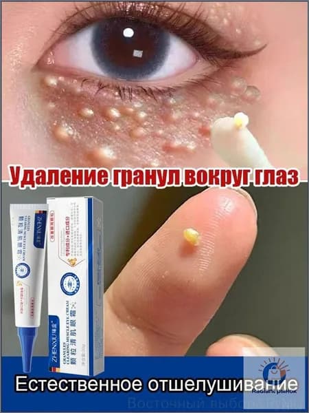 Крем для ухода за кожей вокруг глаз, для белых точек и милиумов, точечное нанесение, 20 г
