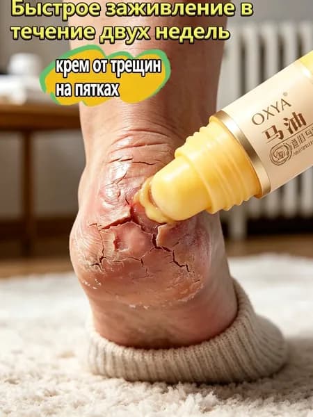 Крем воск от трещин для очень сухой кожи, крем для ног с мочевиной 5%, от трещин на пятках, воск для пяток