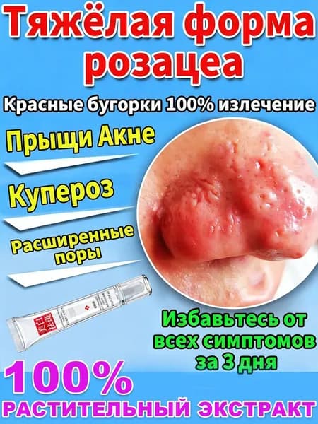 DTMS Сыворотка для лица с азелаиновой кислотой 10% и скваланом от прыщей, восстанавливающий крем, винная мазь орозацеа розацеа, 20г