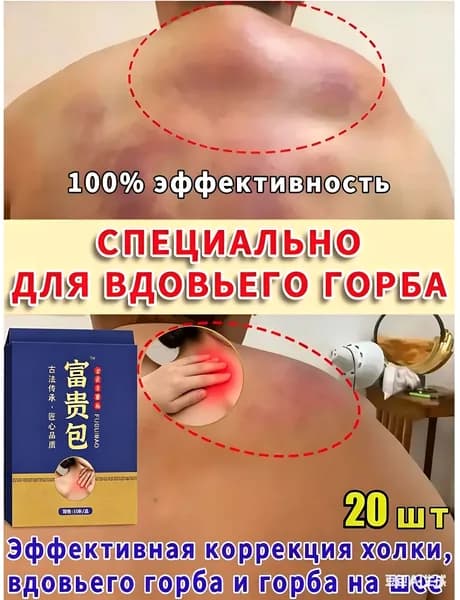 Пластыри для ухода за шеей: от холки, горба и жировых образований. Набор 2 уп. х 10 шт. Снятие дискомфорта, поддержка мышц. Выгодный курс для здоровья спины.
