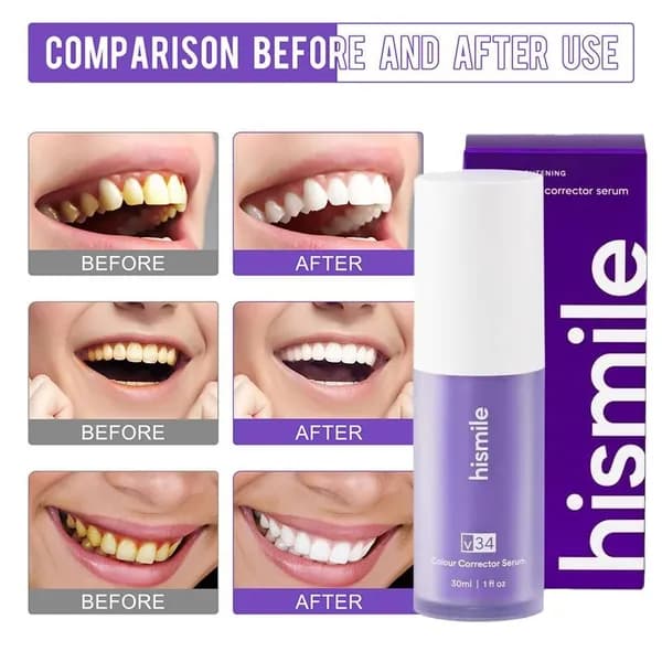 Hismile V34 Фиолетовый отбеливатель для зубов, удаление пятен 30 мл Popular88
