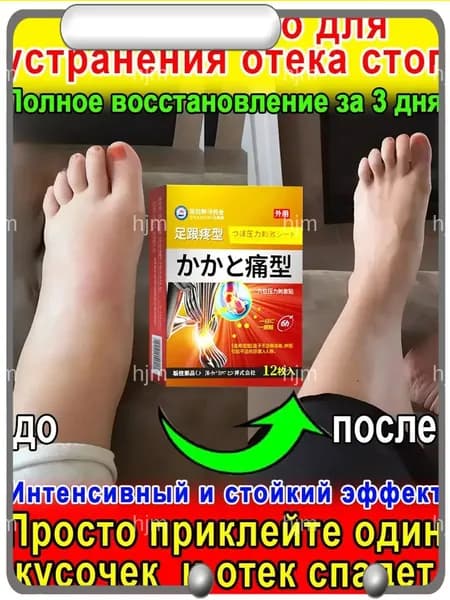 Патчи для ног от отеков тяжести и давления 12 шт - снятие усталости и улучшение кровообращения