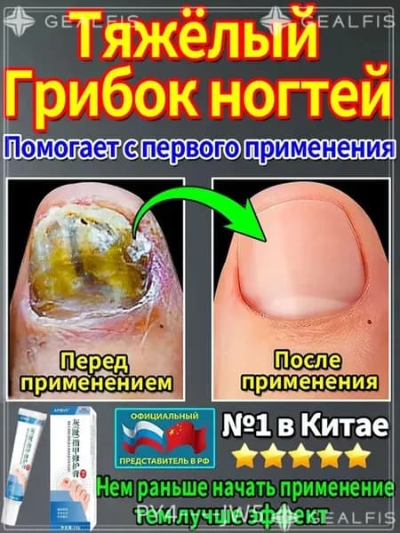 мазь ноготок от грибка ногтей на ногах,Лечите грибковые инфекции, укрепляйте и восстанавливайте ногти и роговой слой кожи, а также устраняйте грибок ногтей на ногах.