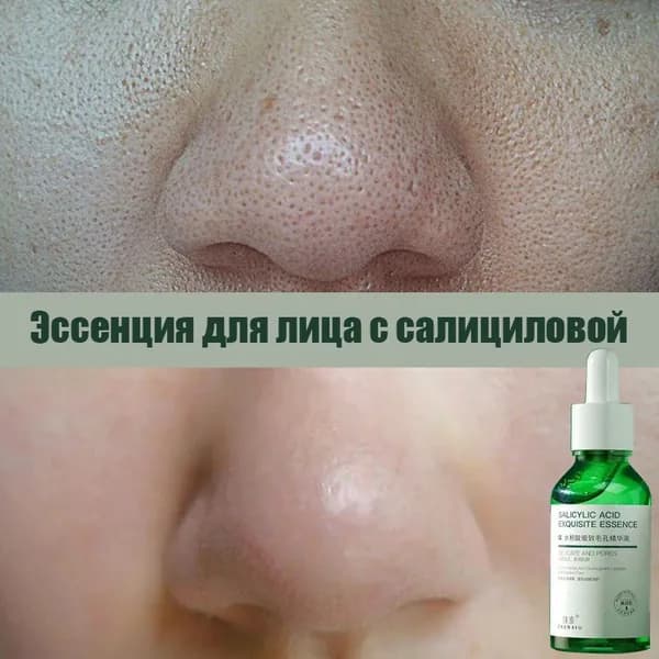 Сыворотка для ухода за кожей Антивозрастной уход, 30 мл