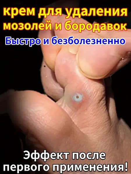 Крем от сухих мозолей стержневых, бородавок, натоптышей, шипиц и пяточных шпор,колломак от бородавок и папиллом,колломак средство от мозолей стержневых на ногах