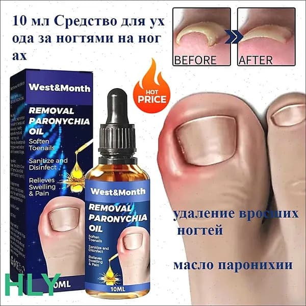 20 г лака для вросших ногтей, устраняет паронихию, укрепляет ногти