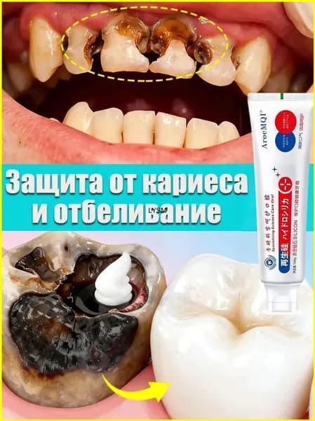 Зубная паста для лечения дырки в зубе, глубокого кариеса и пульпита, Снимает боль, восстанавливает при поражении кариесом у взрослых, Свежее дыхание, 100 г, 1 шт.